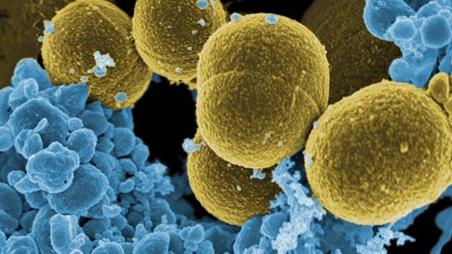 Las ‘antivitaminas’ pueden salvar a la humanidad de las infecciones resistentes a los antibióticos, afirma un nuevo estudio