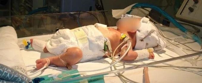 Un bebé es envenenado por sus padres en potosí