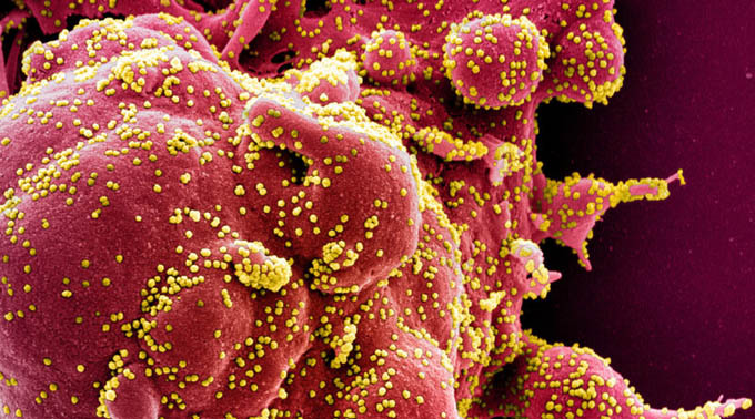 Científicos descubren una sustancia capaz de bloquear la absorción del coronavirus.
